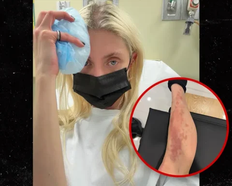 Taylor Momsen spider bite