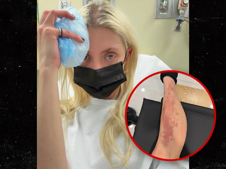 Taylor Momsen spider bite